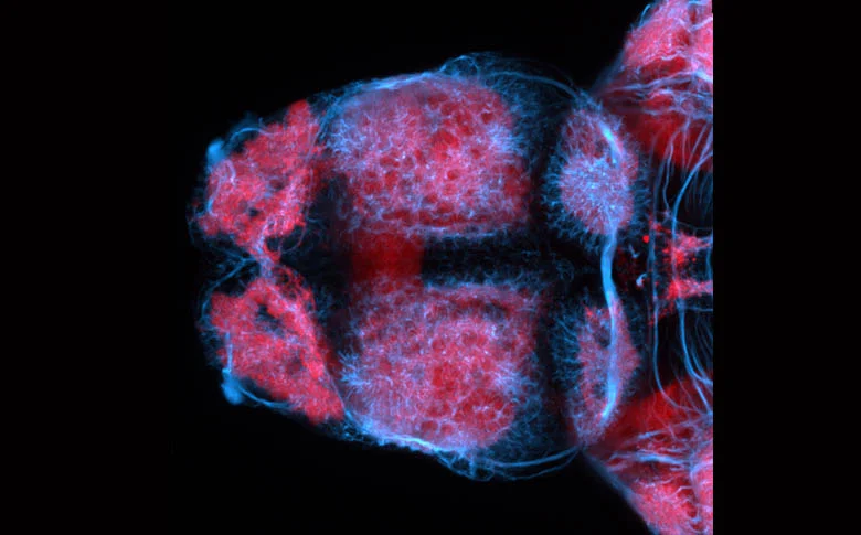 Dorsal view of the forebrain of a zebrafish larva showing axons (blue) and neuropil (pink).
