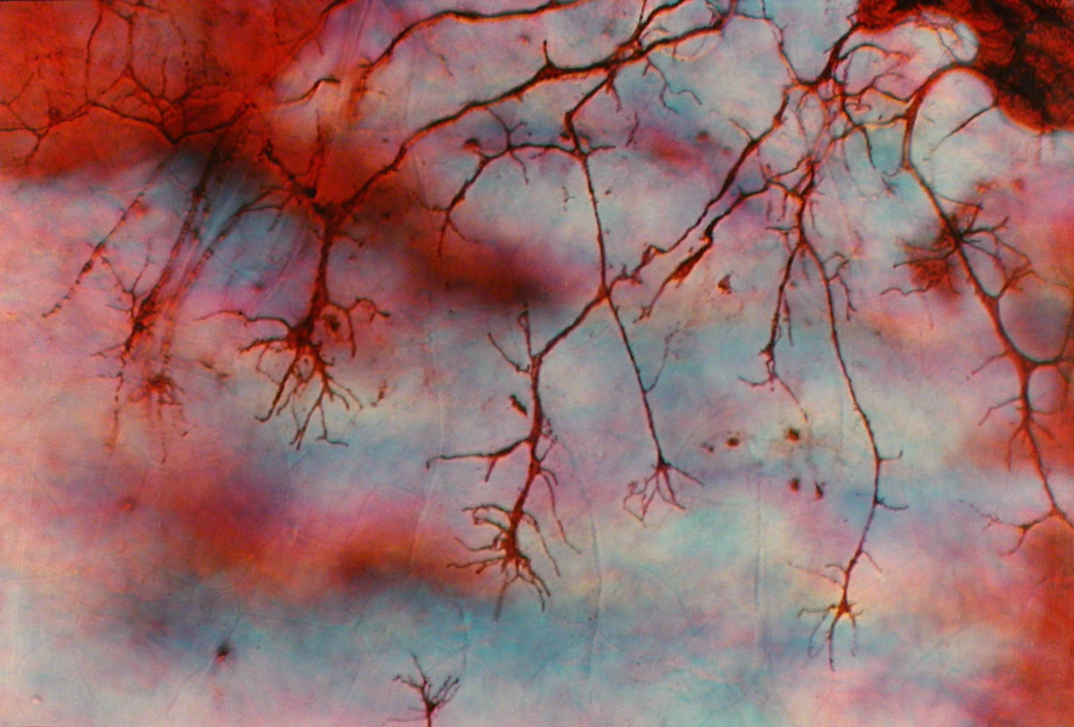 Axon extension