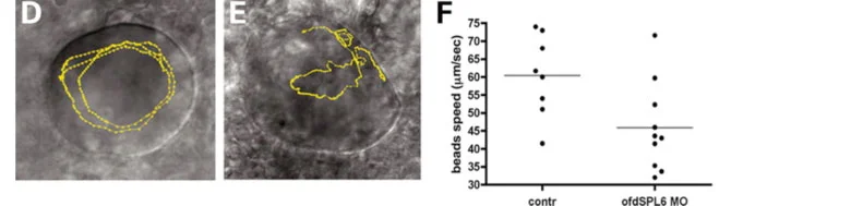 Figure 1. Cilia movement is disrupted when Ofd1 doesn't function: the yellow line shows the path of a single bead inside Kupffers' vesicle, A is a normal embryo, while B is an embryo where Ofd1 function is disrupted. The plot shows the difference in bead speed between normal and affected embryos