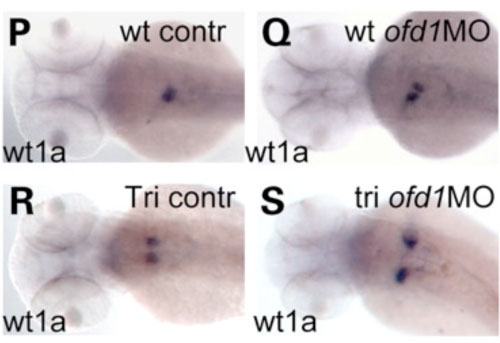 Figure 4. The pronephroic glomerulus (the precursor of the kidney) forms from two primordia that migrate towards the midline and fuse. In ofd1 compromised embryos, this process is impaired, and we observed the same phenomenon in mutant fish called trilobite (tri) that carry a mutation in vangl2. We speculate that this could be another consequence of disrupting Wnt/Pcp dependent cell migrations.