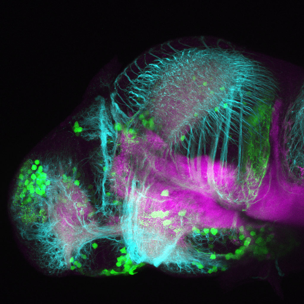 Tg(slc6a3:EGFP) 3dpf Lateral View SV2 TUB