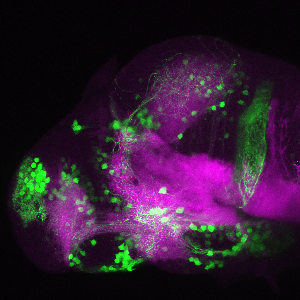 Tg(slc6a3:EGFP) 3dpf Lateral View SV2