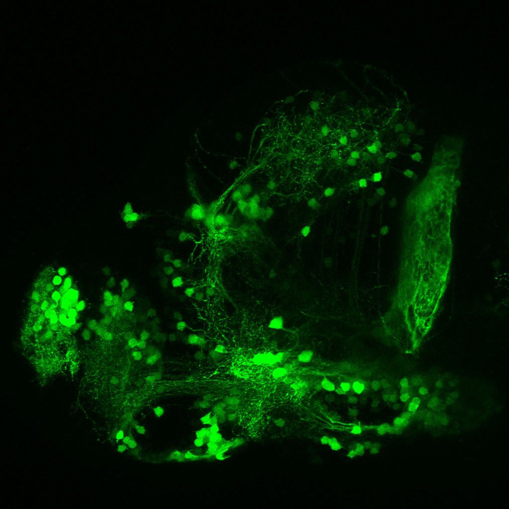 Tg(slc6a3:EGFP) 3dpf Lateral View 