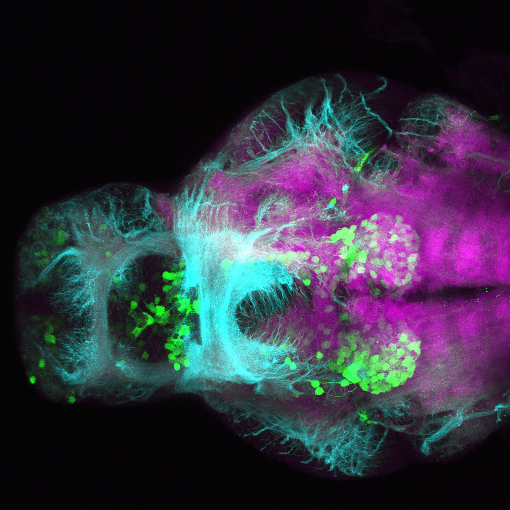 Tg(slc6a3:EGFP) 3dpf Ventral View SV2 TUB