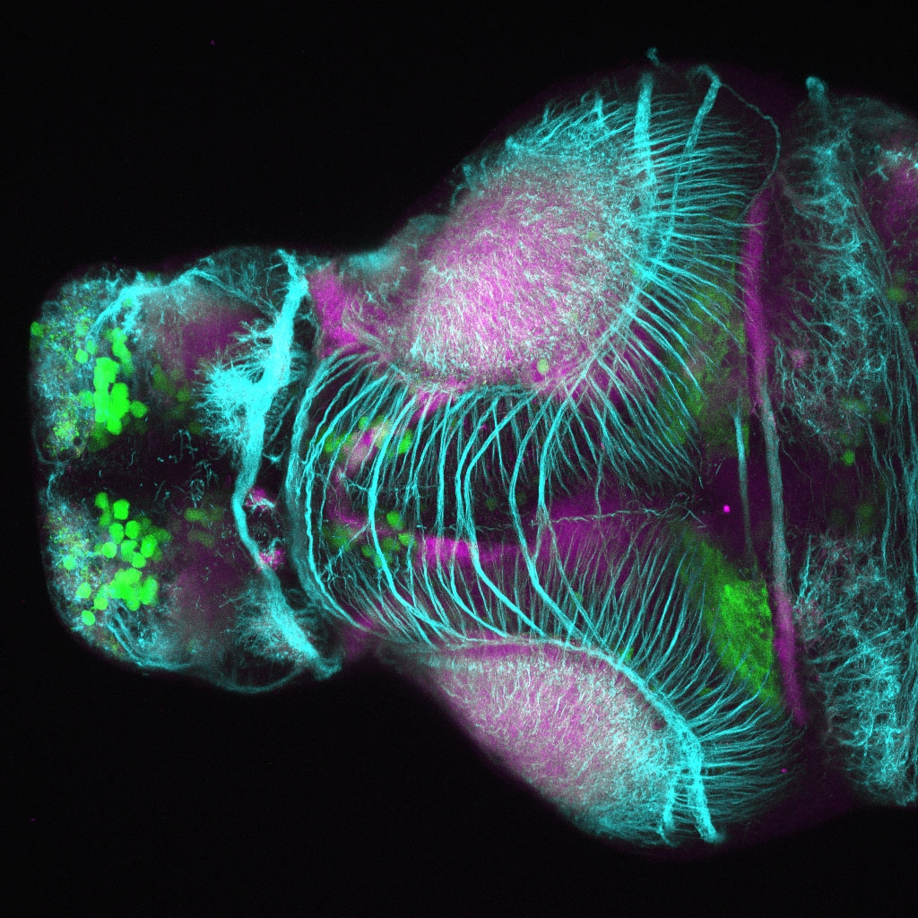 Tg(slc6a3:EGFP) 3dpf Dorsal View SV2 TUB