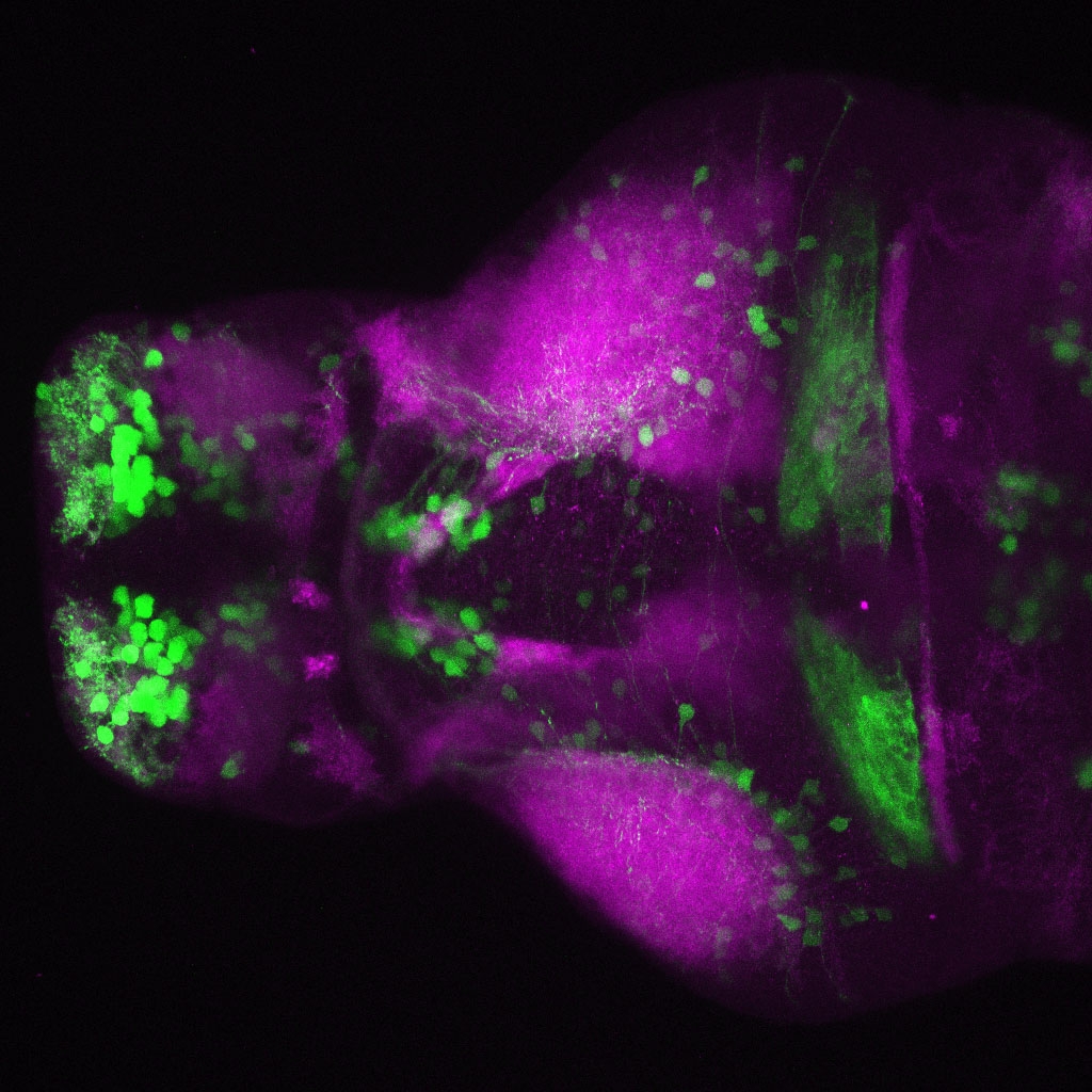 Tg(slc6a3:EGFP) 3dpf Dorsal View SV2