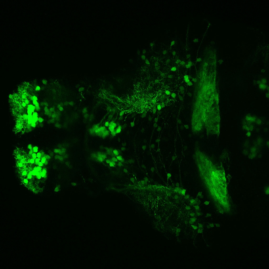 Tg(slc6a3:EGFP) 3dpf Dorsal View 