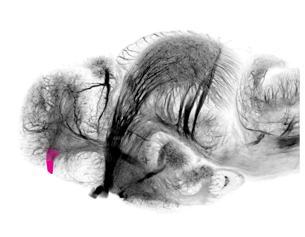 anterior commissure