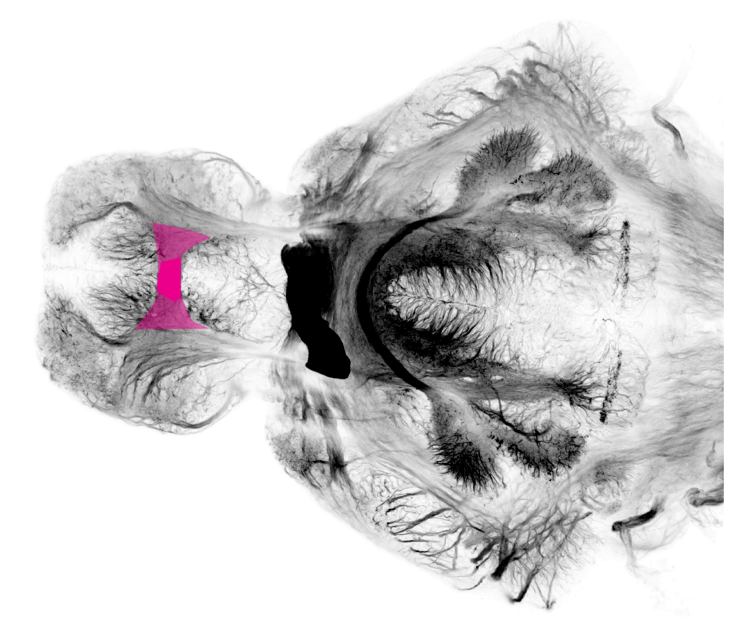 anterior commissure