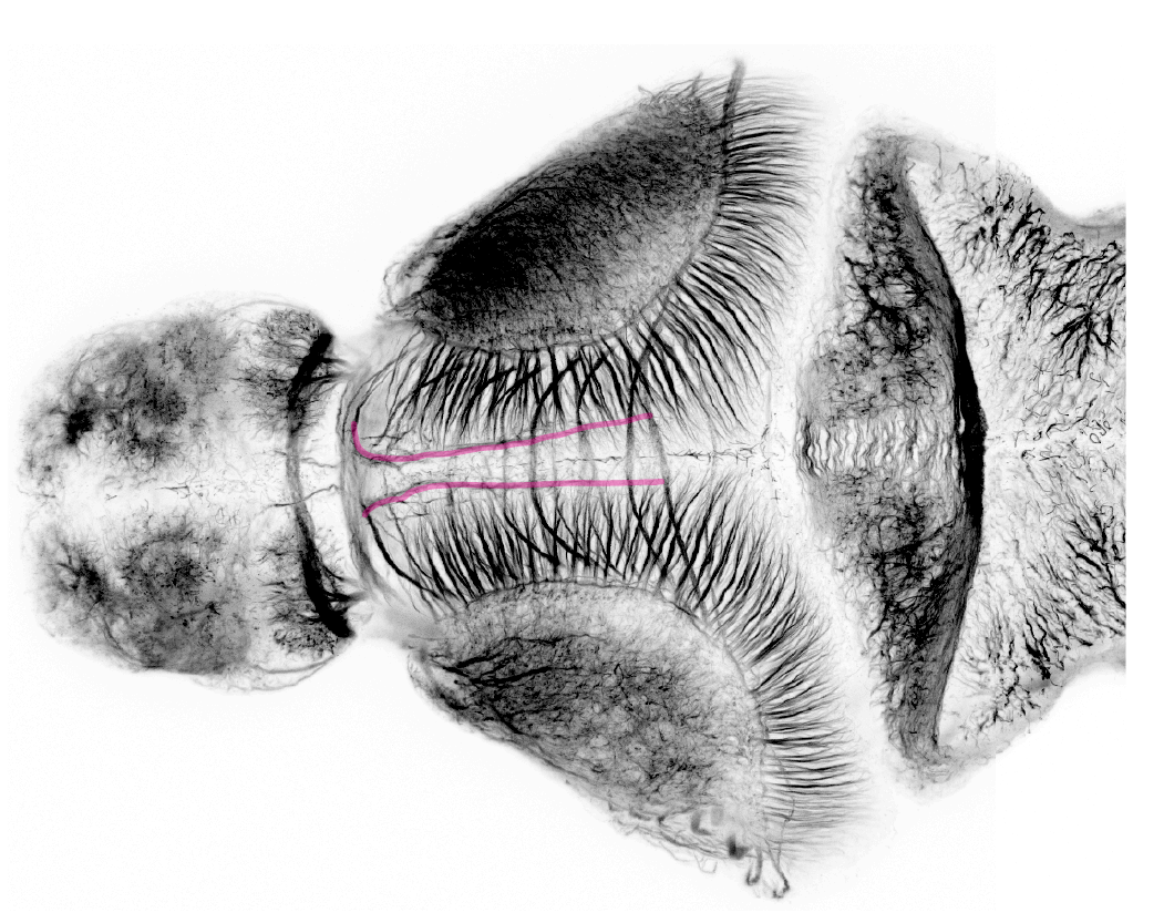 torus longitudinalis