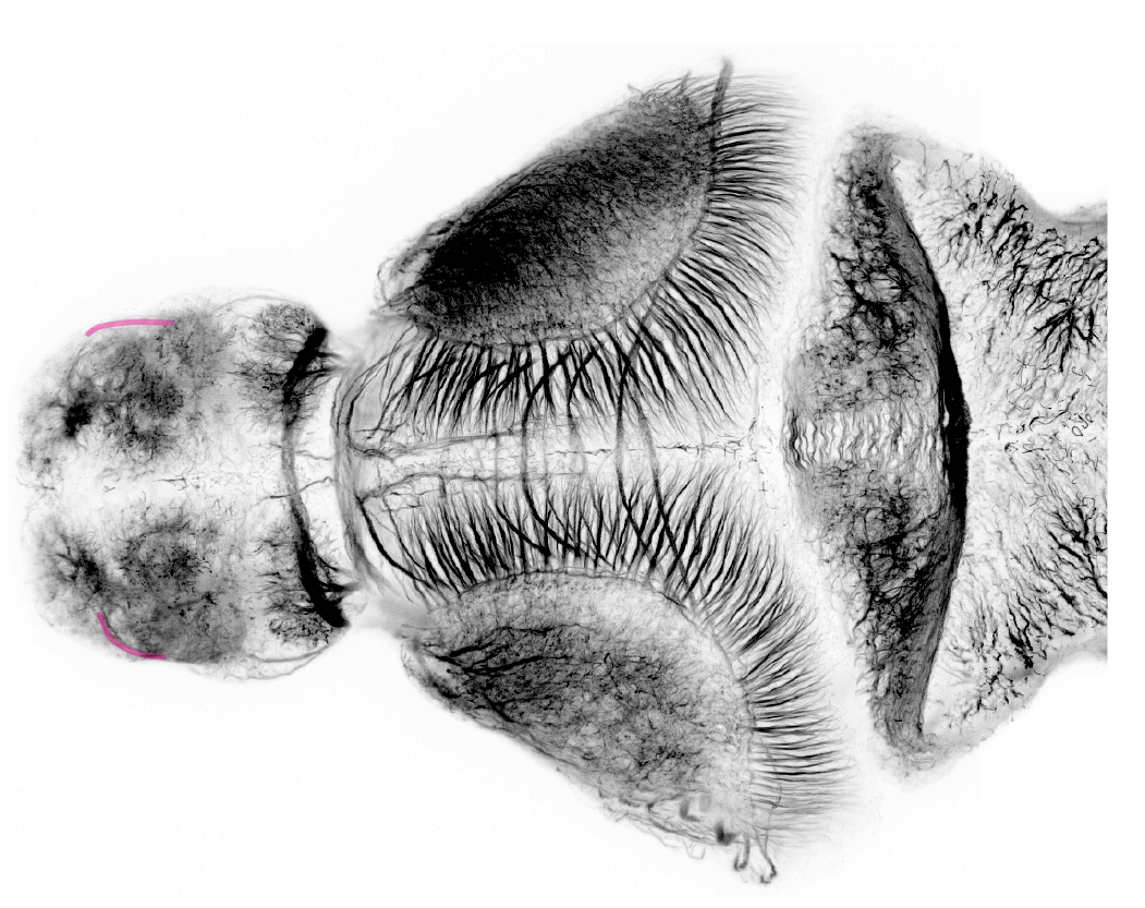 lateral olfactory tract