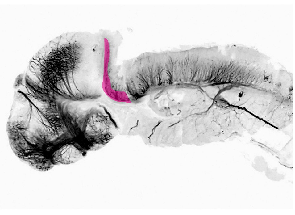 cerebellar commissure