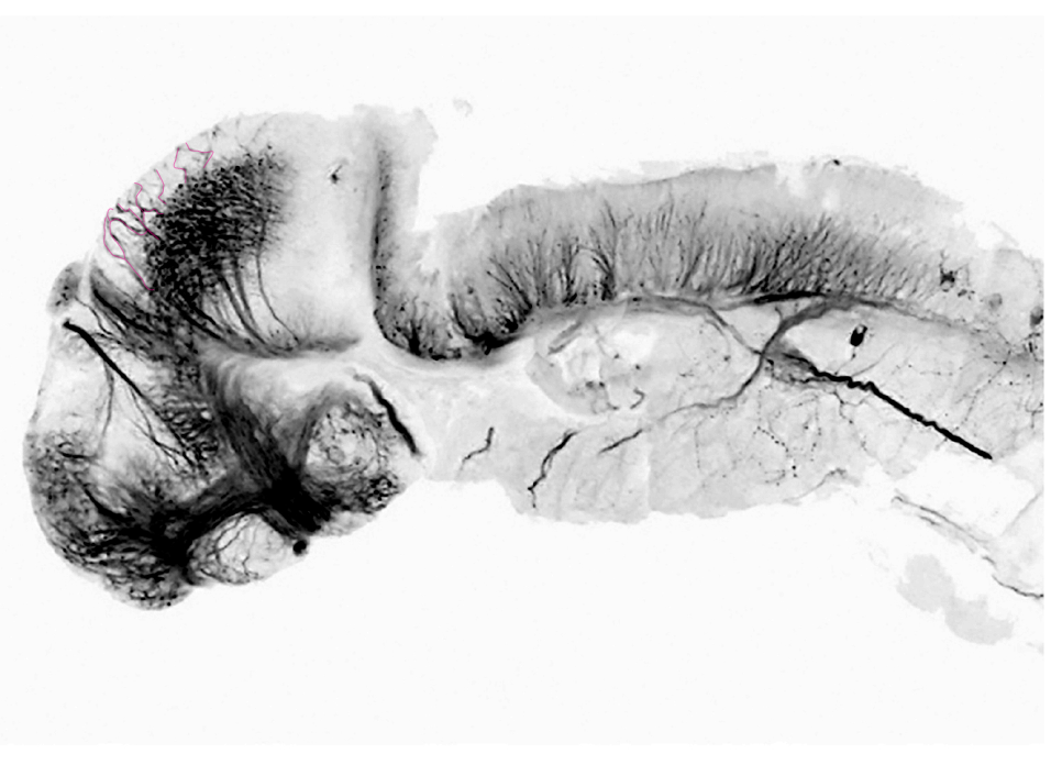 intertectal fascicles and commissures