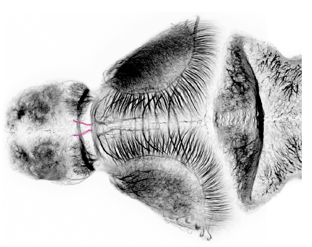 dorsoventral diencephalic tract