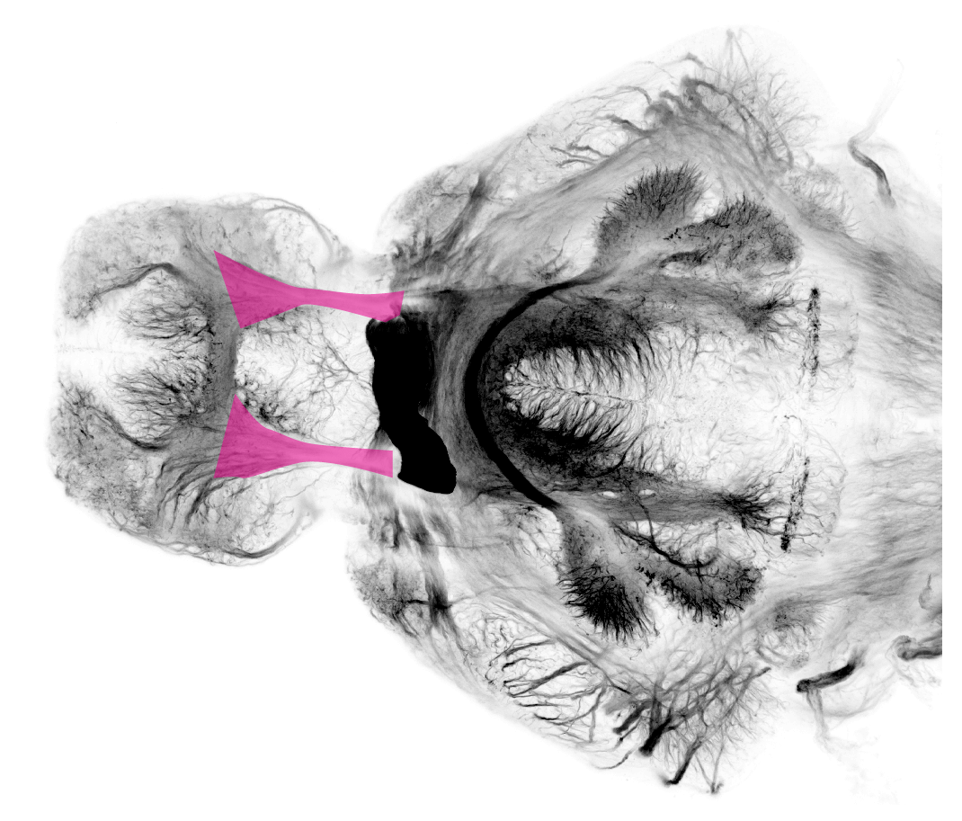 supraoptic tract/lateral forebrain bundle