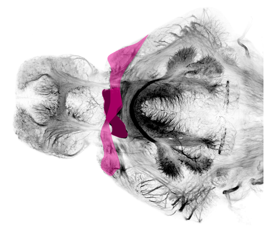 optic tract