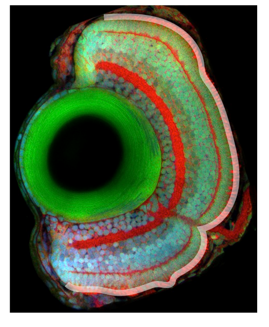 outer segment photoreceptors
