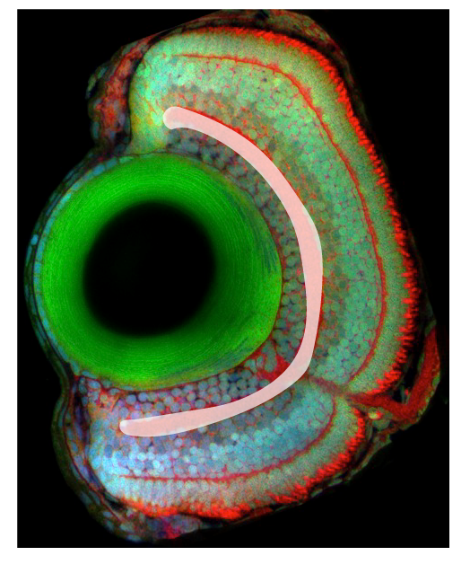 inner plexiform layer