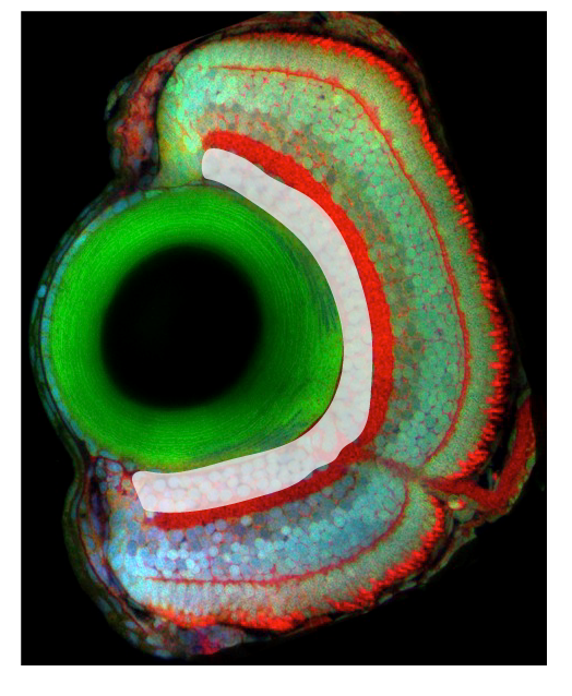 retinal ganglion cell layer