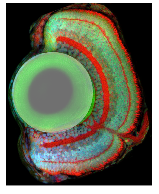 Lens