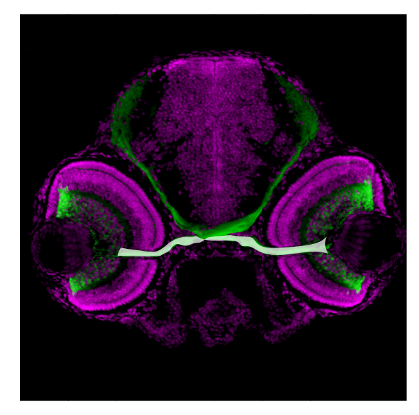optic nerve