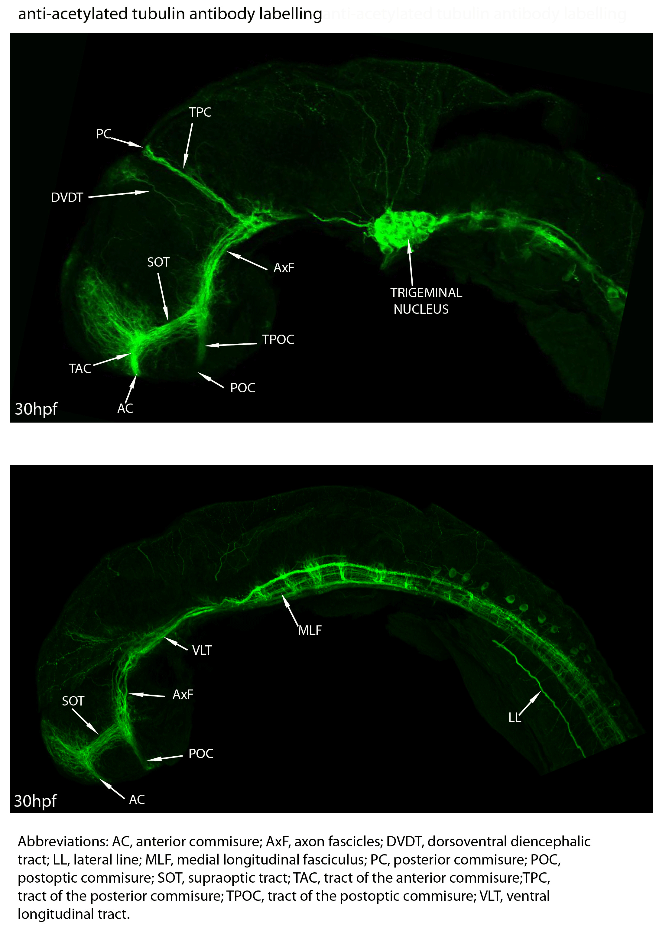 woodshole_tubulin_labelled.gif