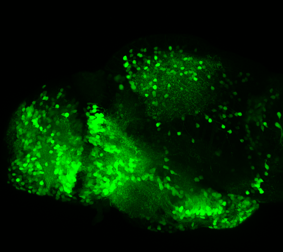 Lateral view of a 4dpf Tg(1.4dlx5a-dlx6a:GFP)ot1