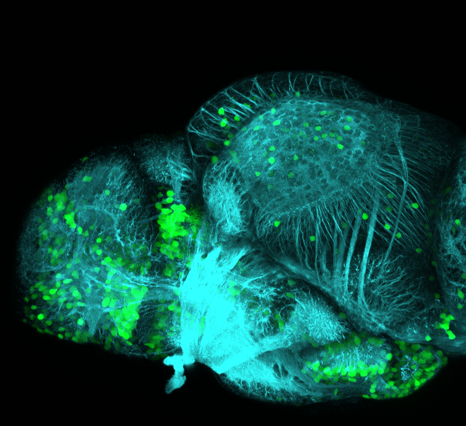 Lateral view of a 4dpf Tg(1.4dlx5a-dlx6a:GFP)ot1