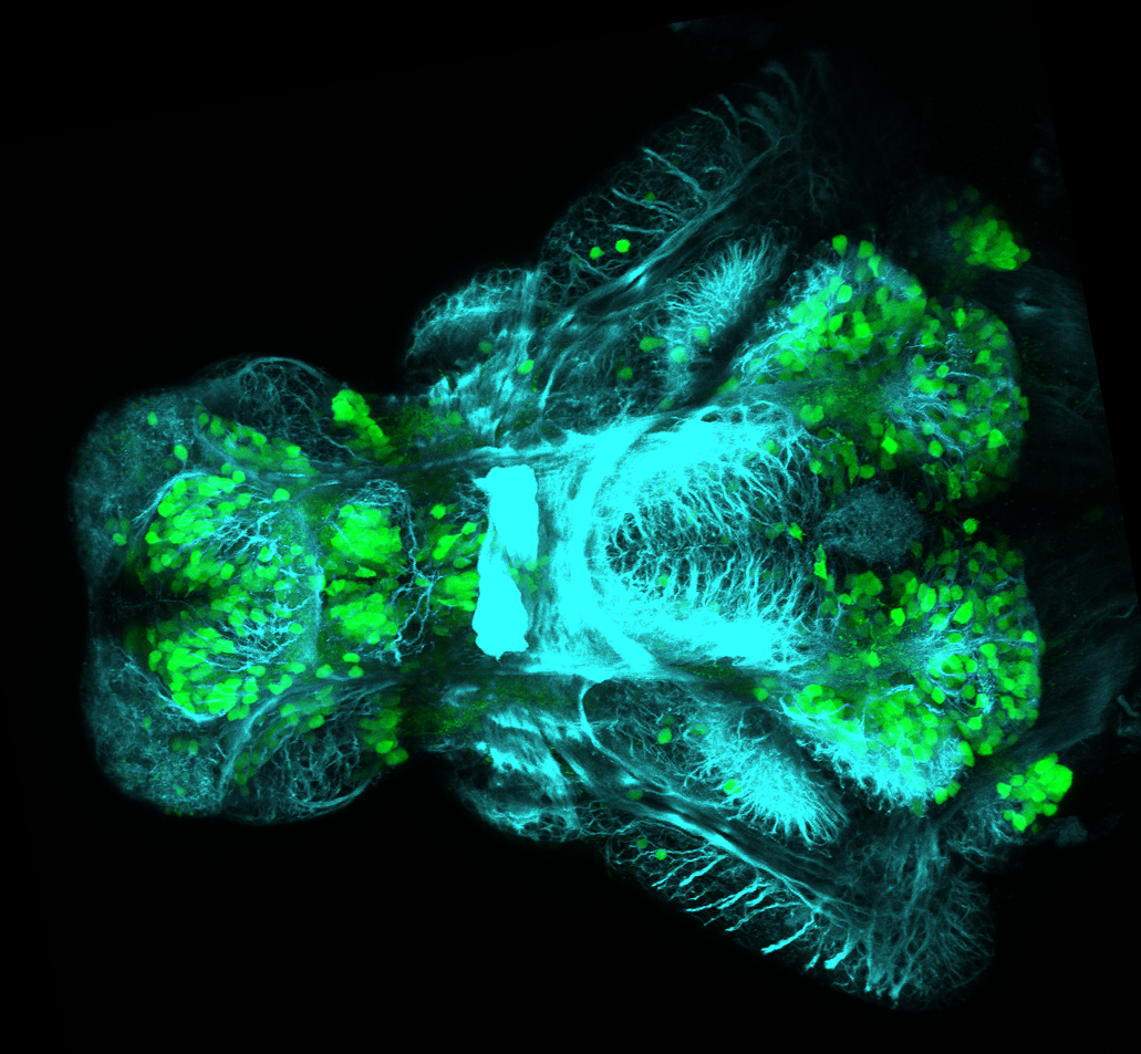 Ventral view of a 4dpf Tg(1.4dlx5a-dlx6a:GFP)ot1 larvae