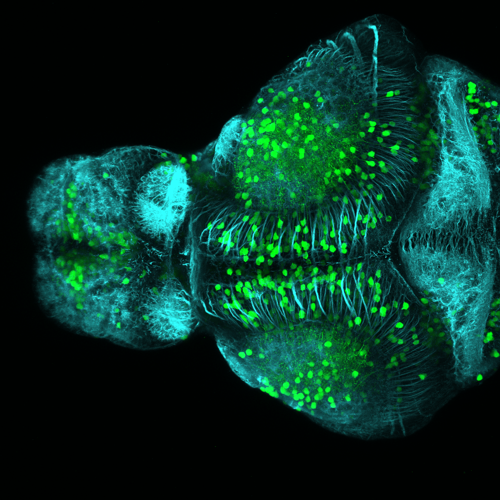 Dorsal view of a 4dpf Tg(1.4dlx5a-dlx6a:GFP)ot1 larvae