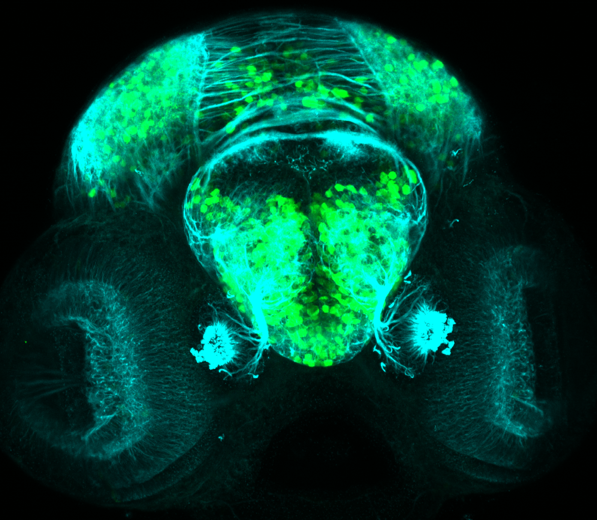 3dpf frontal view of dlx:GFP larvae