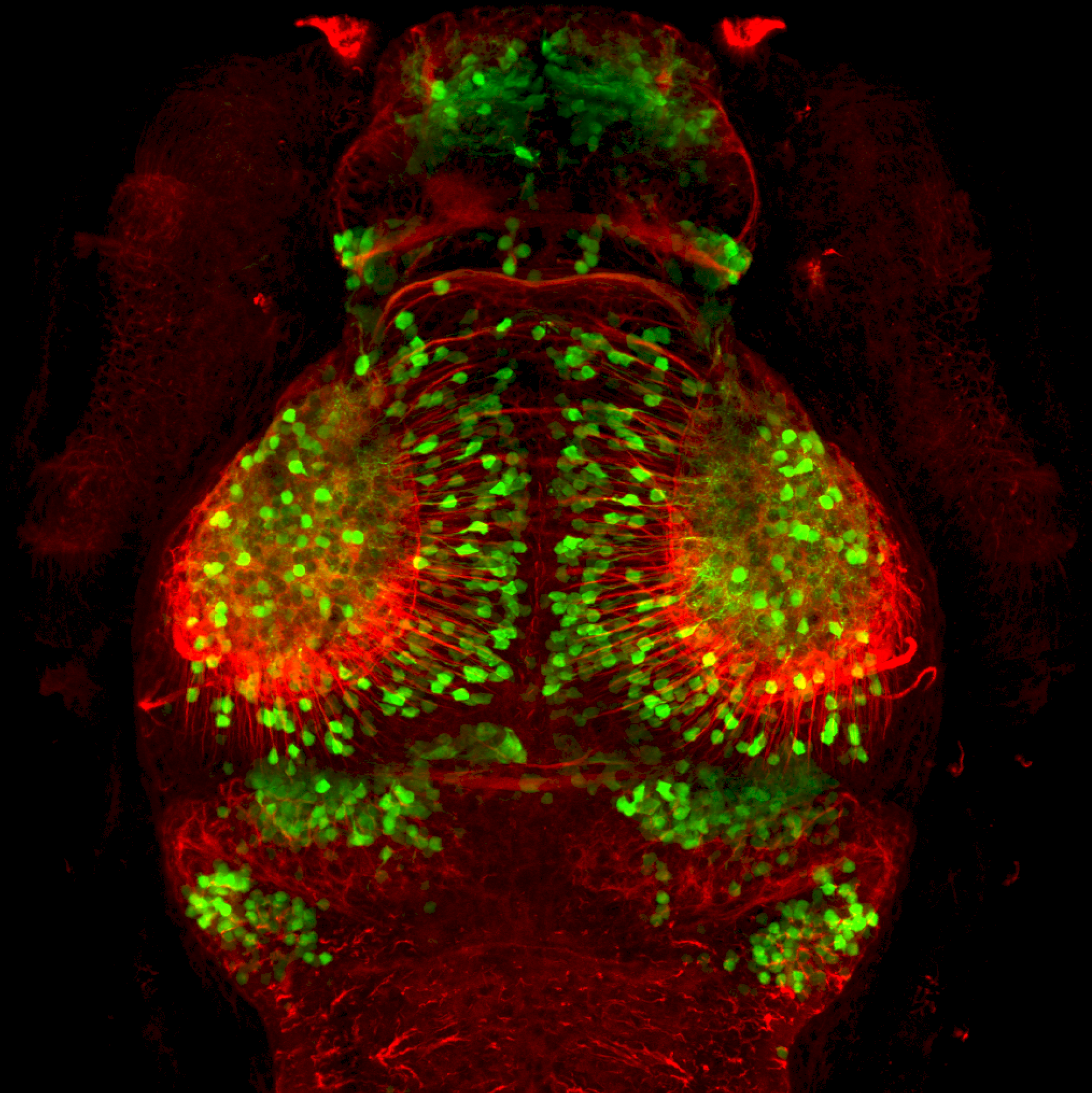 3dpf dorsal view dlx:GFP