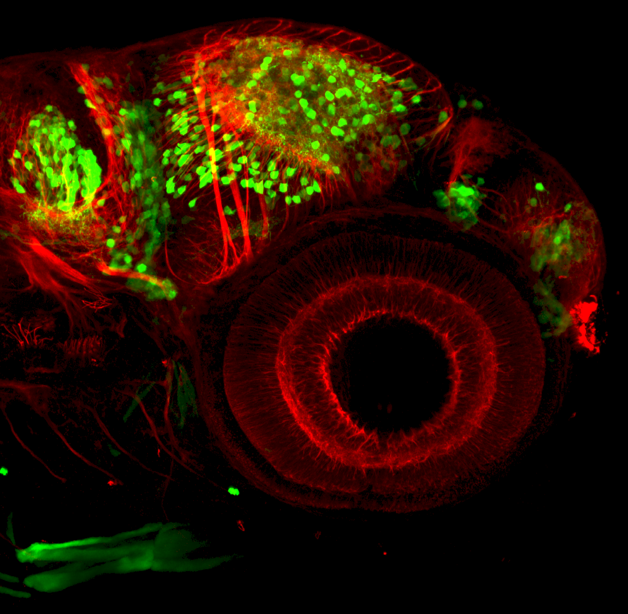 3dpf lateral view of dlx:GFP in forebrain