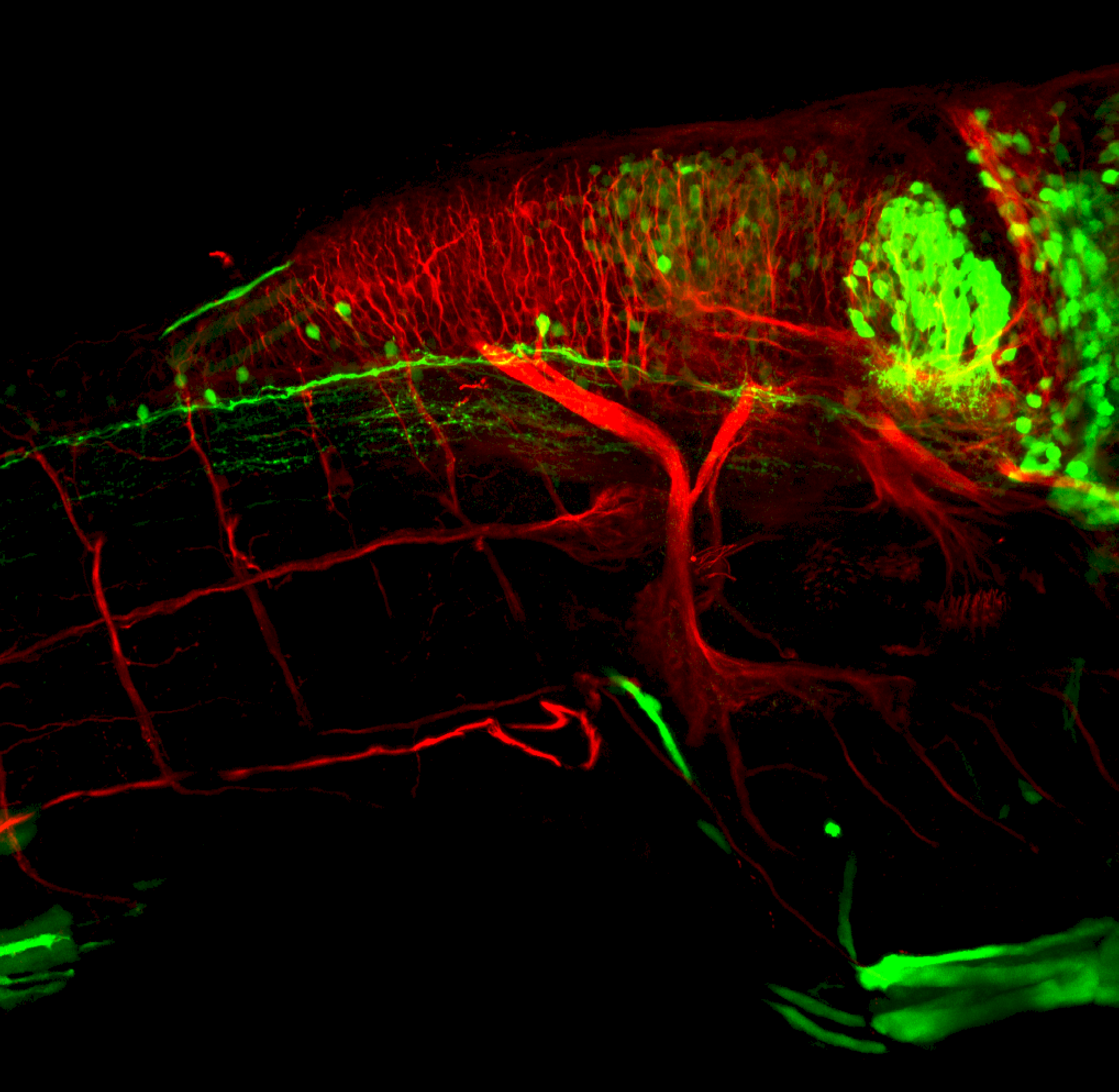 3dpf late view of dlx:GFP hindbrain