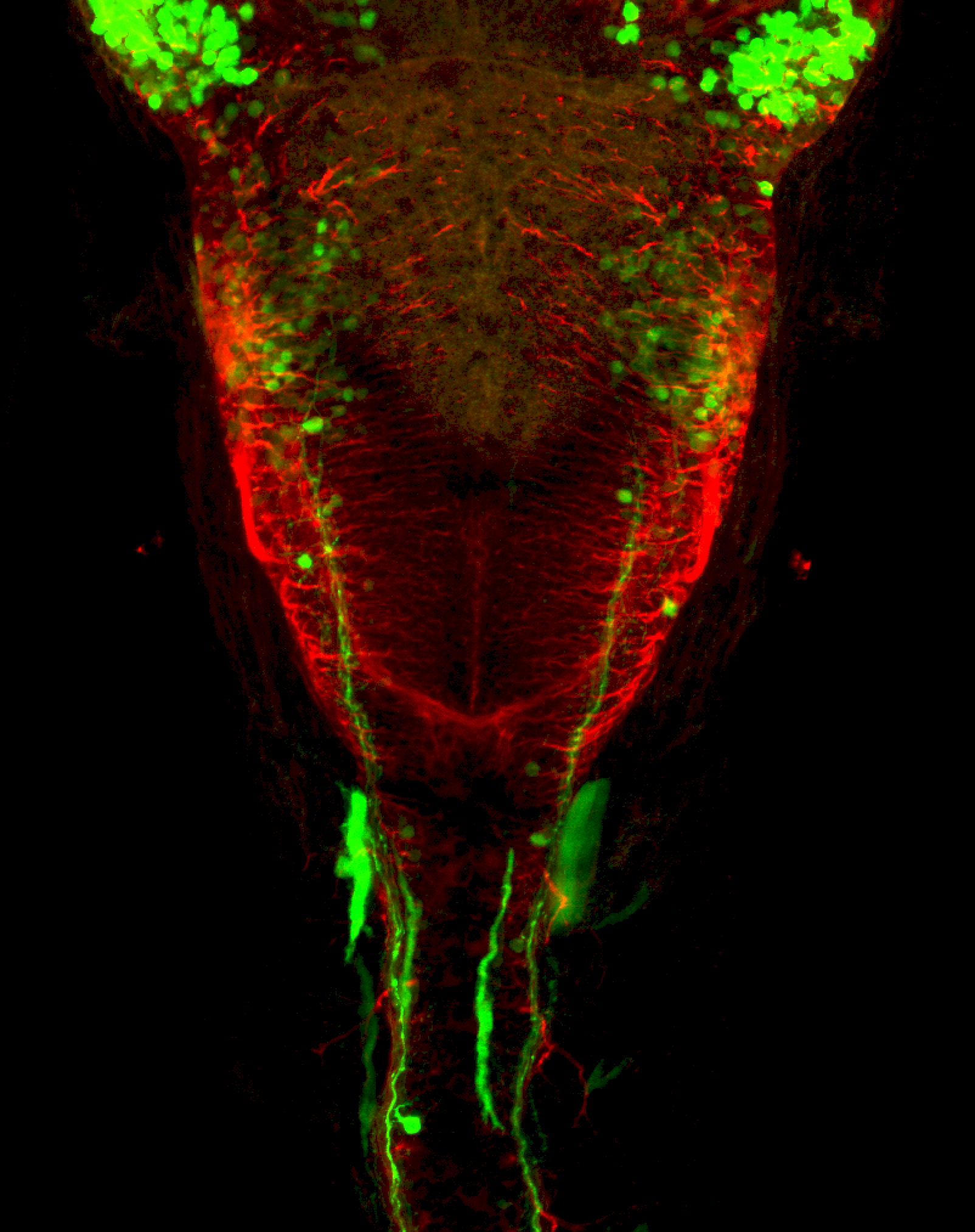 3dpf dorsal view of dlx:GFP hindbrain