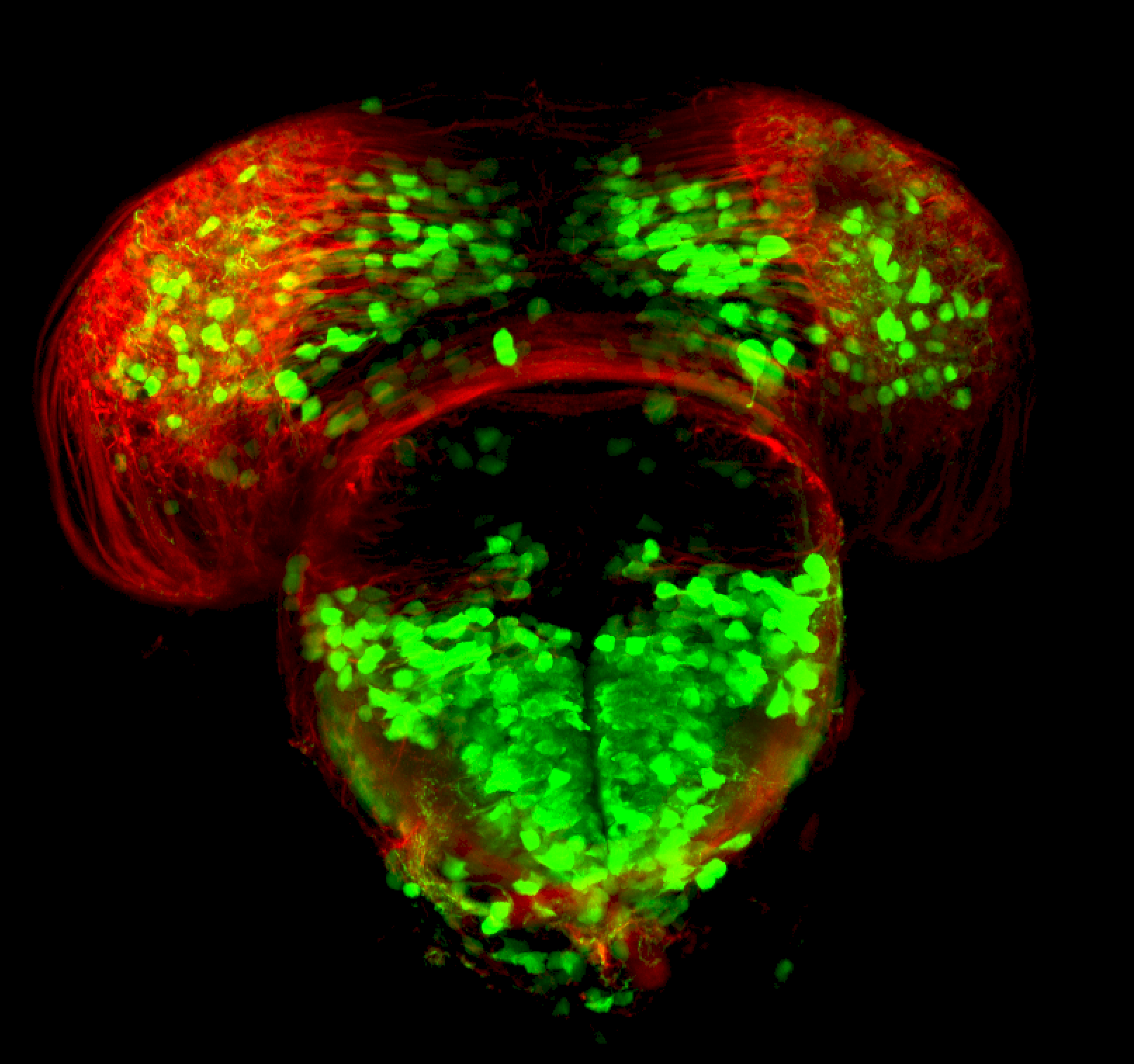 3dpf frontal section of dlx:GFP subpallium