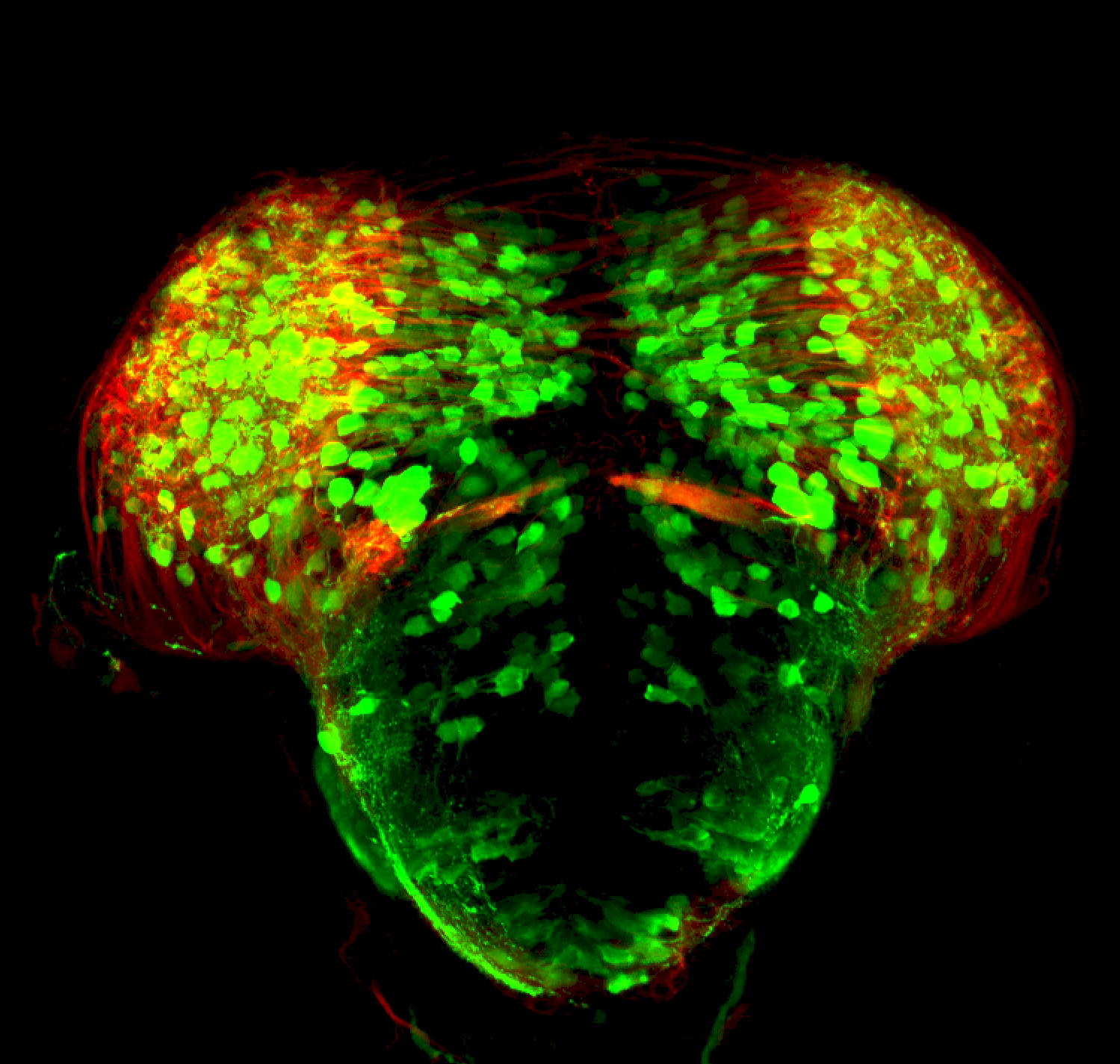 3dpf thick section of dlx:GFP through midbrain/diencephalon