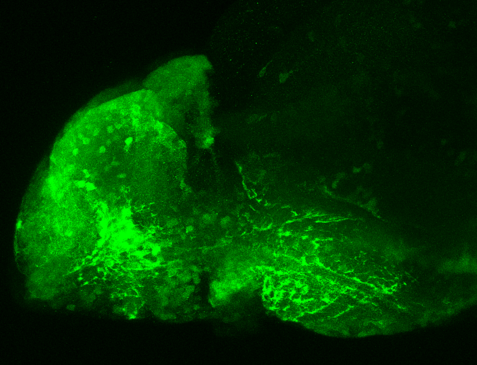 Et(fos:Gal4-VP16)s1137t lateral 4dpf