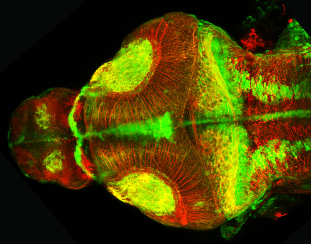 shh:GFP and tubulin. 4dpf dorsal view