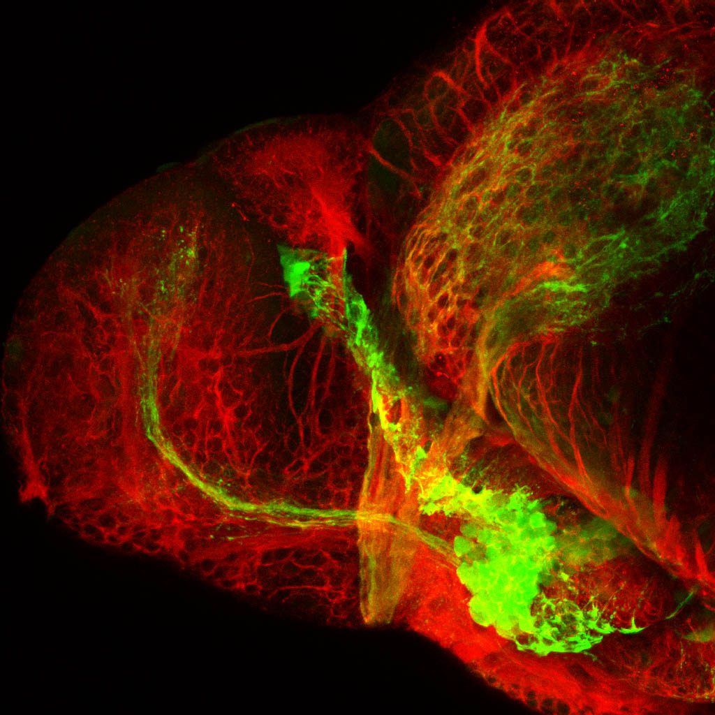shh:GFP and tubulin. 4 dpf lateral forebrain