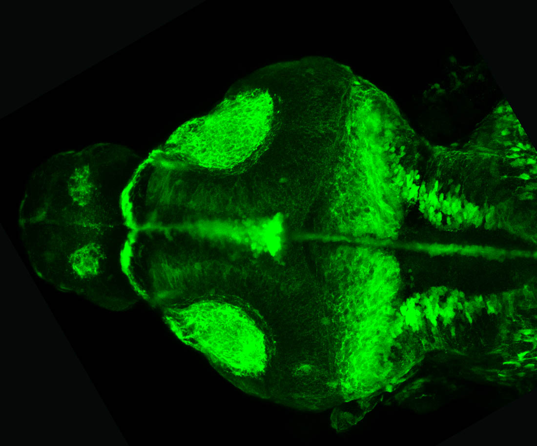 shh:GFP dorsal view of 4dpf larvae