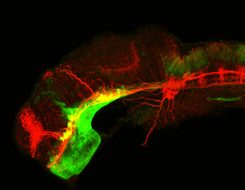 shh:GFP and tubulin lateral view of 24hpf