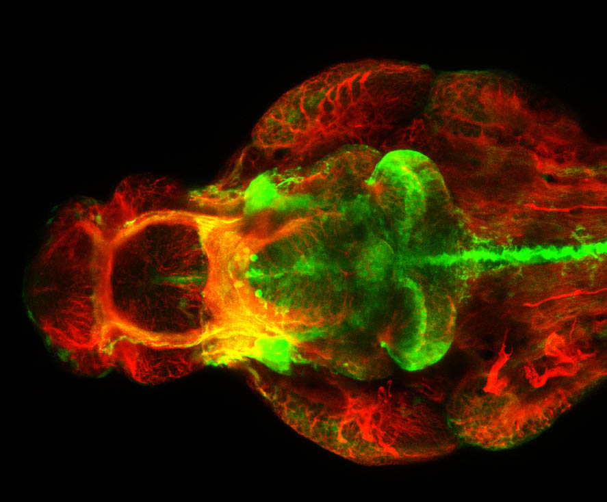 shh:GFP, tubulin 4dpf ventral view