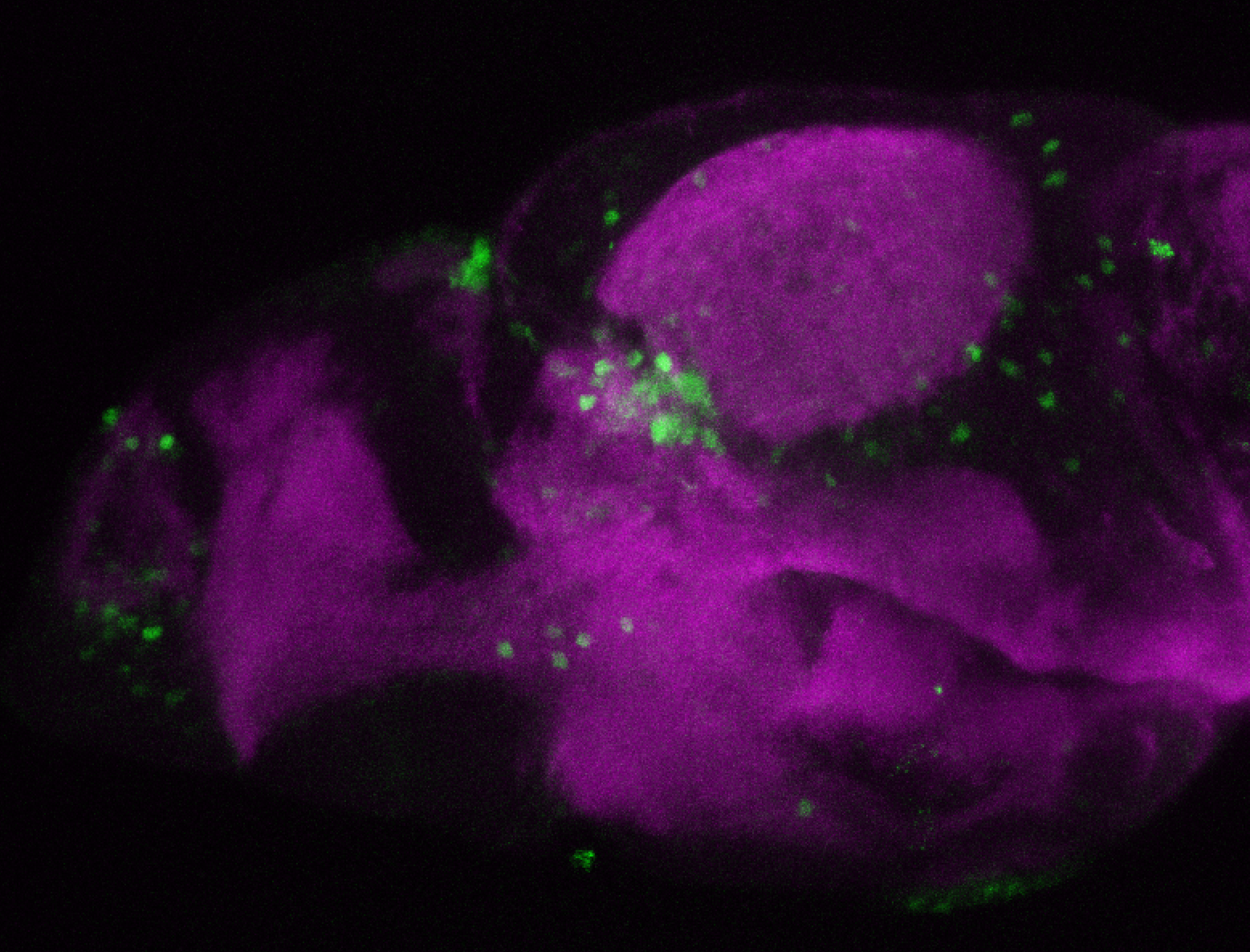 sox3h7:EGFP with SV2 lateral view 4dpf