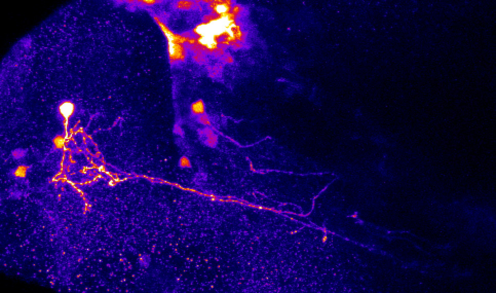 pallial neuron in sox3h10 lateral view at 5dpf