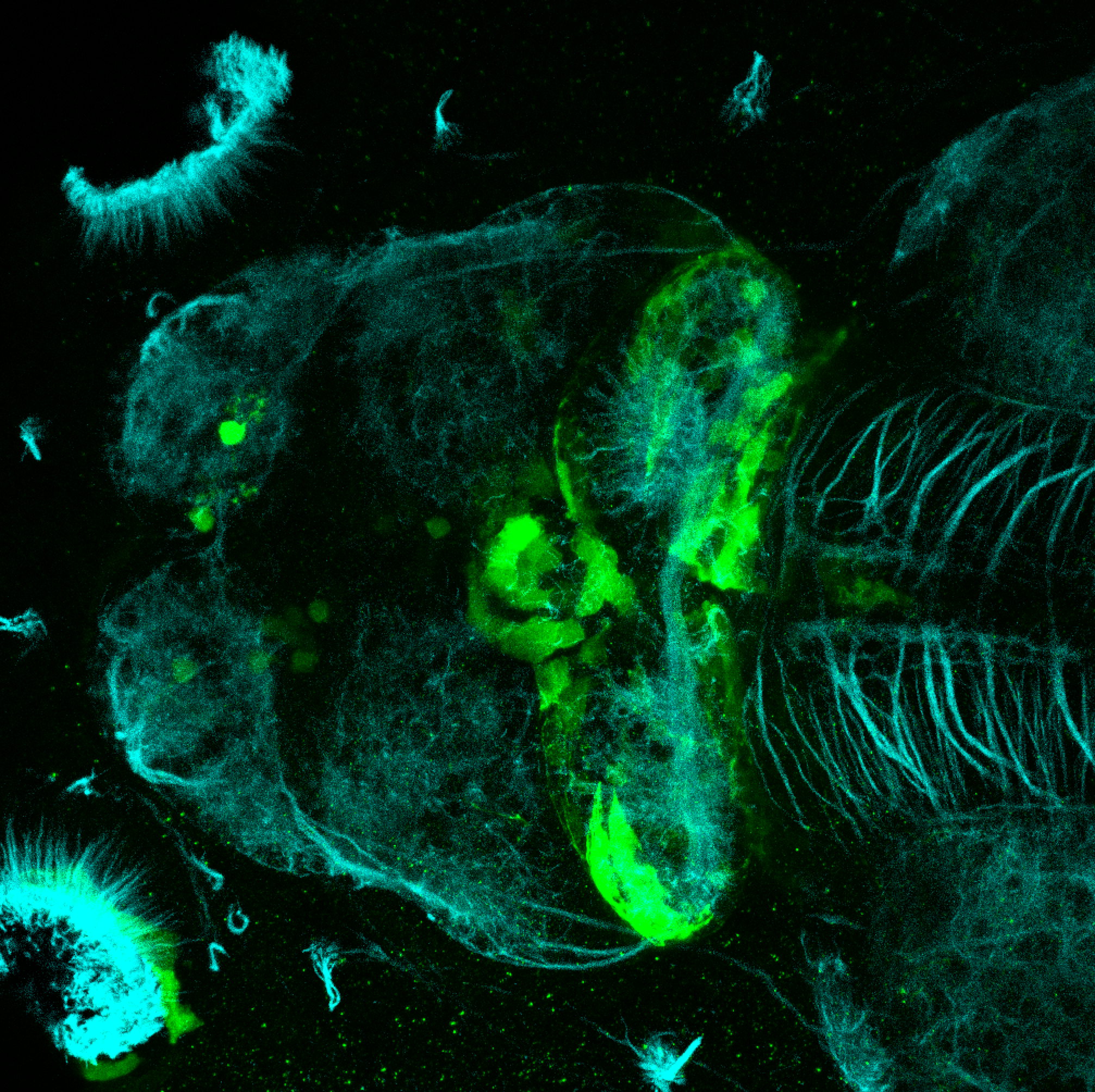 sox3h10:EGFP and tubulin dorsal view at 5dpf