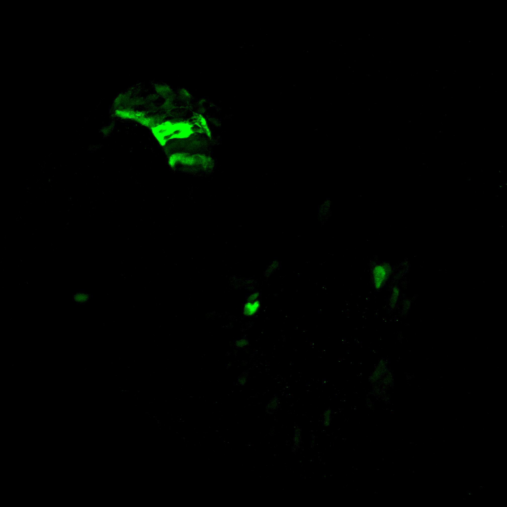 sox3h10:EGFP Lateral view at 2dpf
