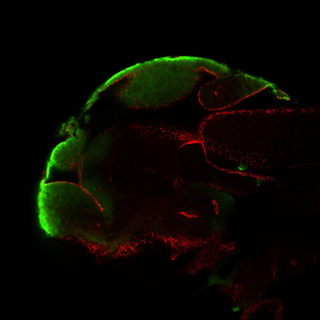 ET33:EGFP and zo1 lateral view at 2dpf