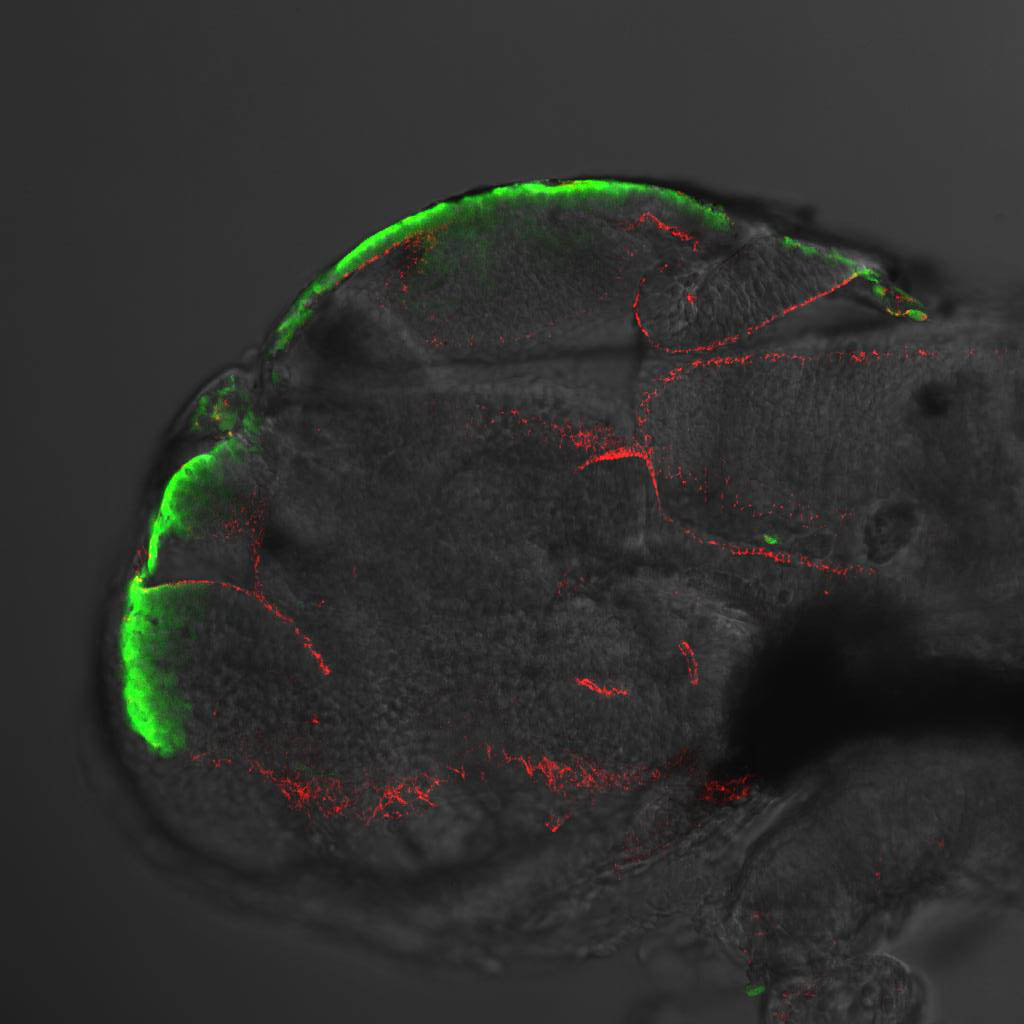 ET33:EGFP and zo1 lateral view at 2dpf