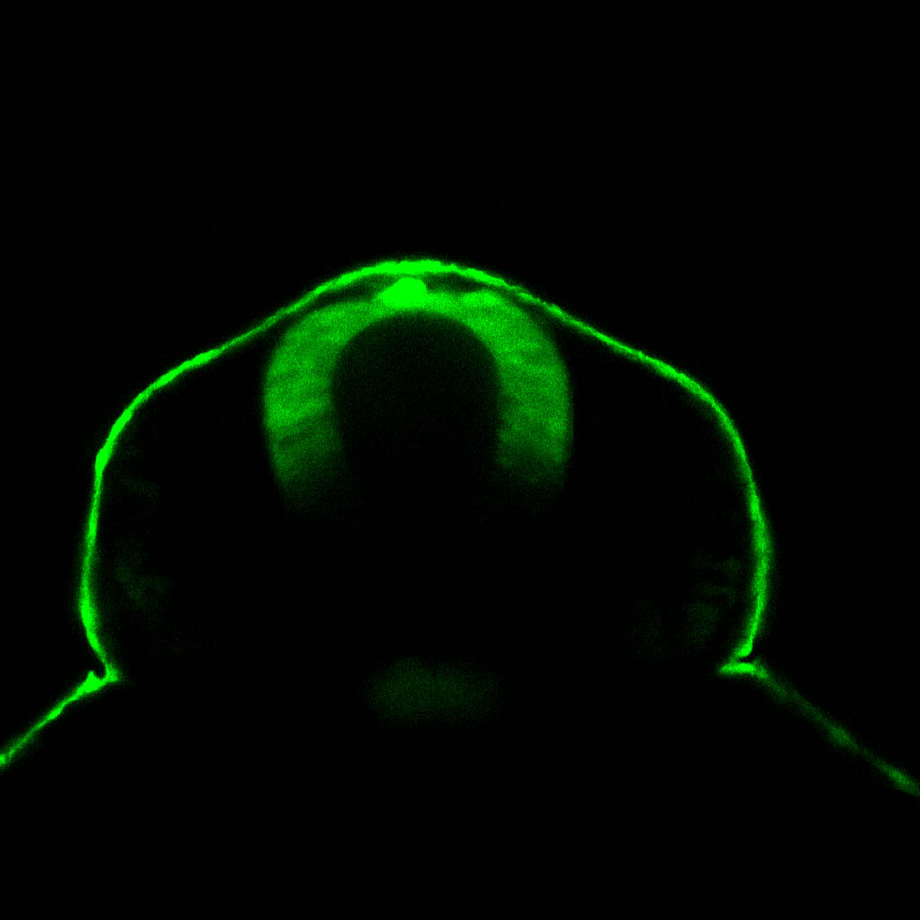 ET33:EGFP frontal view